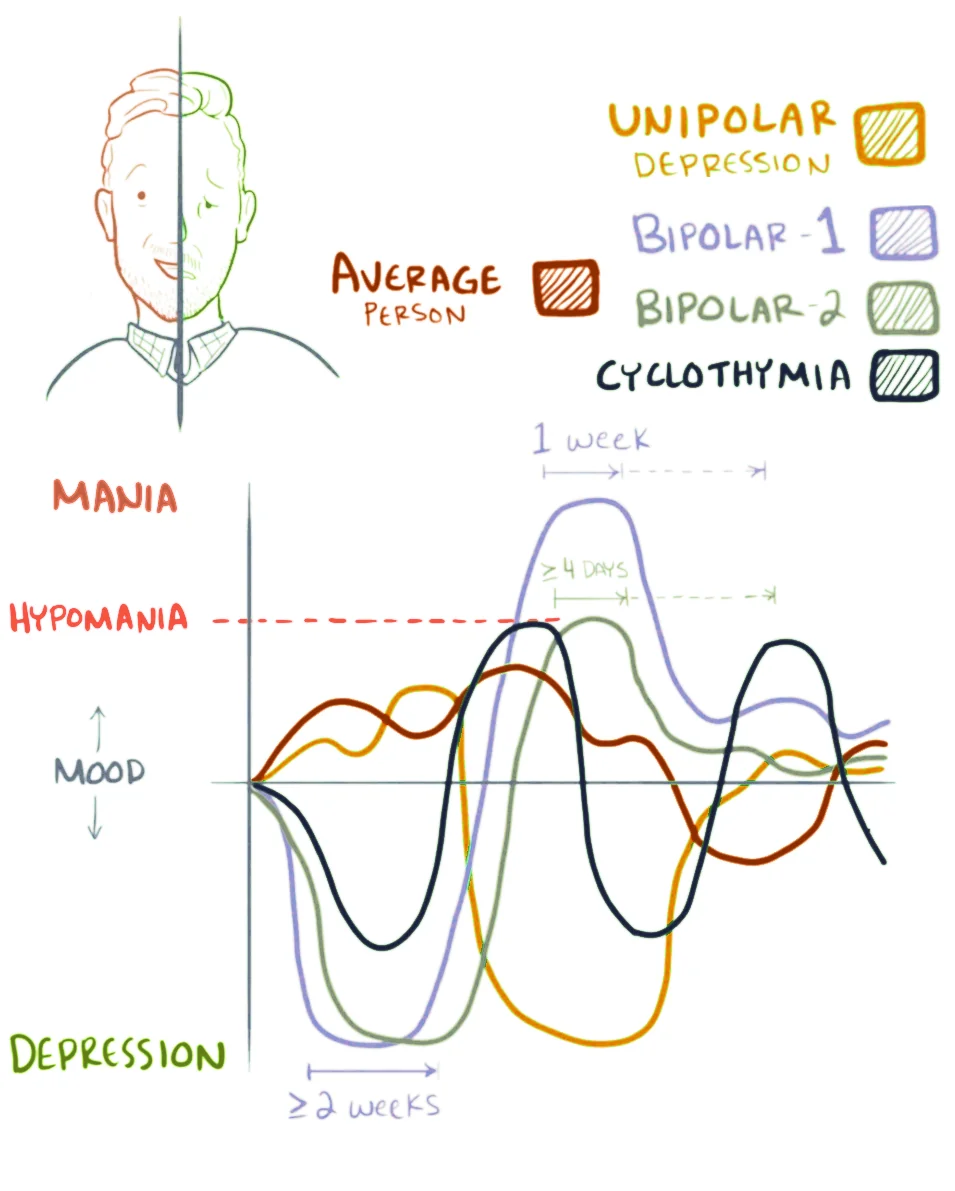 Graph of mood against time comparing an average person, unipolar depression, bipolar I, bipolar II and cyclothymia, with horizontal thresholds marked for mania and hypomania and duration markers of at least one week for mania, at least four days for hypomania and at least two weeks for a depressive episode.