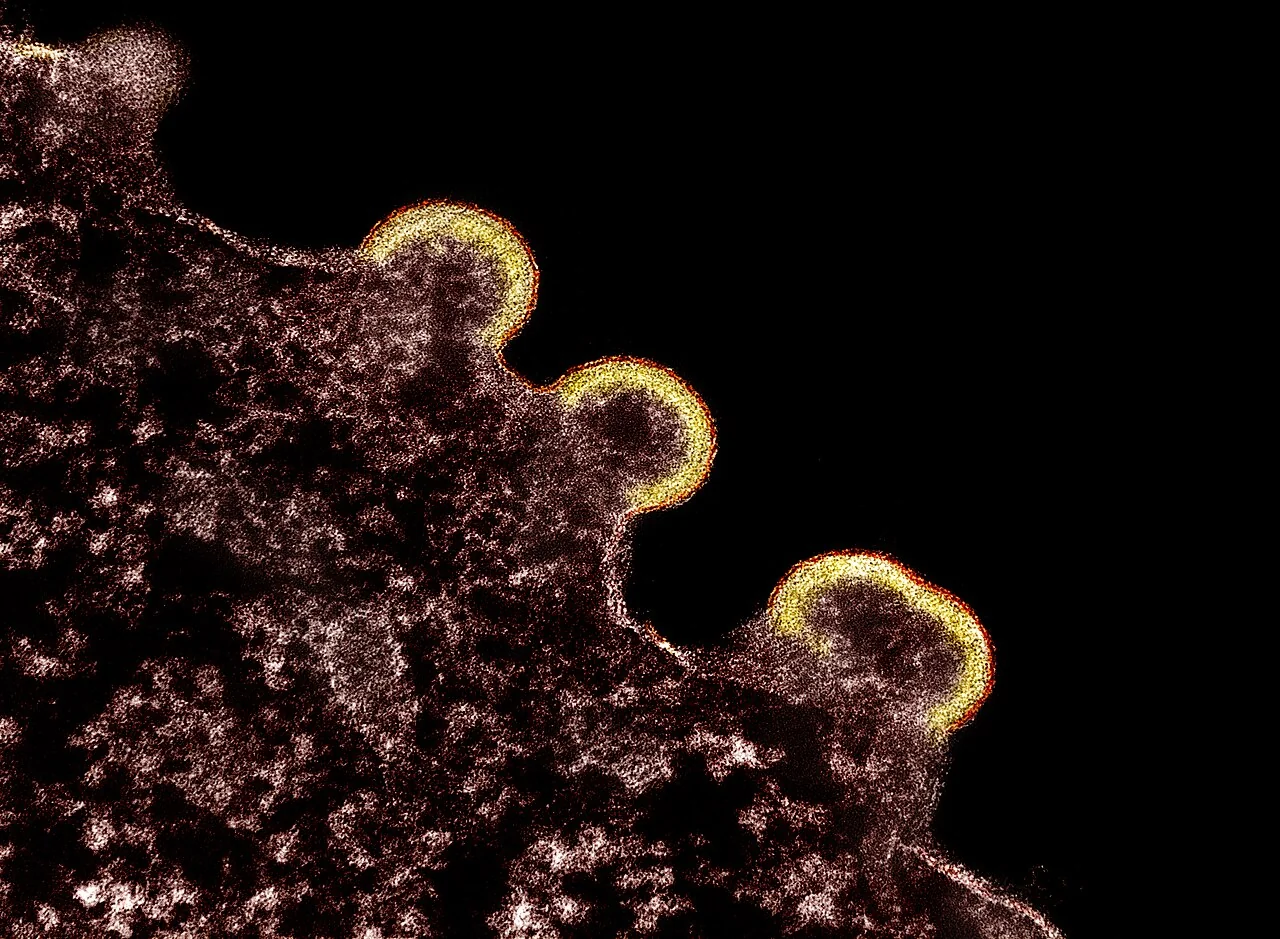 Colourised transmission electron micrograph showing HIV-1 virus particles budding from the surface of an infected T cell.