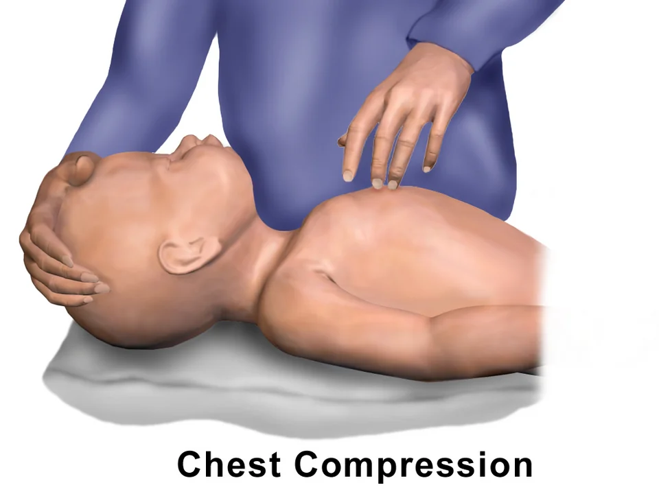 Illustration of a rescuer performing chest compressions on an infant lying supine, using two fingertips on the lower half of the sternum while the other hand supports the head.