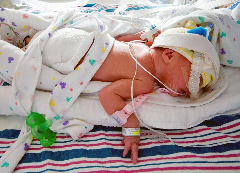 A very small preterm infant lying in a transparent incubator on a neonatal unit, with monitoring leads and a nasal tube in place.