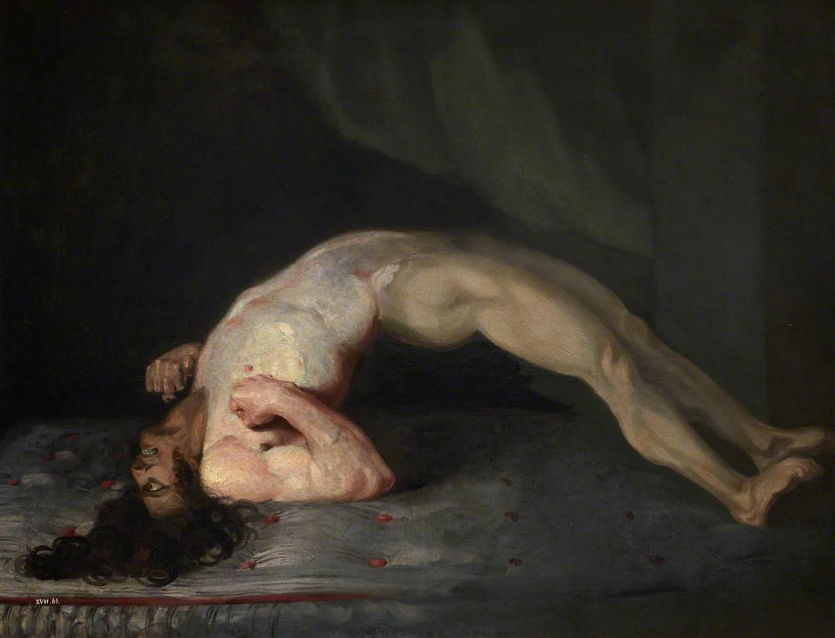 Historical painting of a soldier with severe muscular rigidity and back arching (opisthotonus) from tetanus.