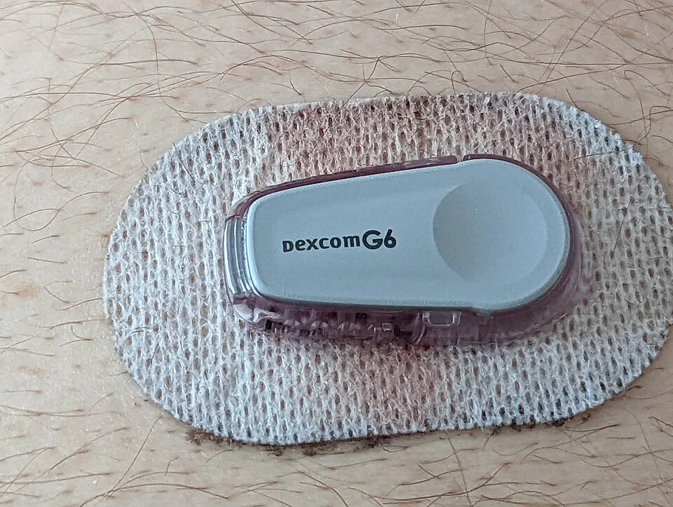 A small oval white continuous glucose monitor sensor adhered to the skin of the abdomen by an oval fabric adhesive patch, photographed close up.